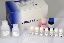 Helicobacter Pylori IgM elisa kits
